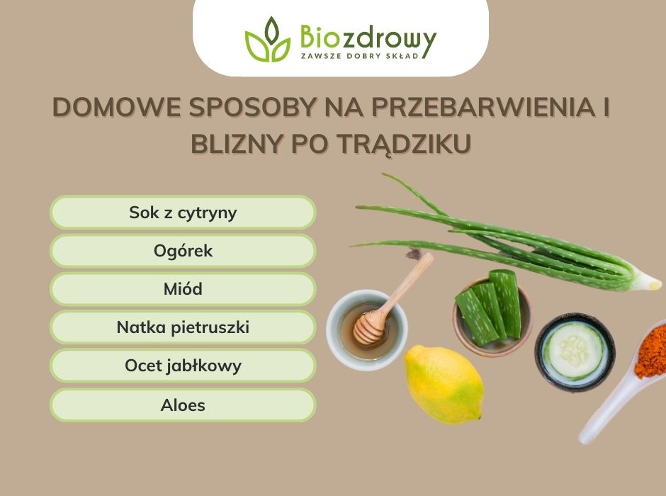 Domowe sposoby na przebarwienia i blizny po trądziku - infografika