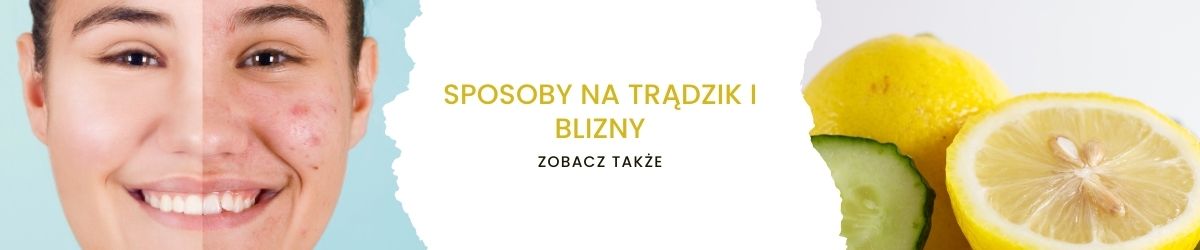 Sposoby na trądzik i blizny - obrazek zobacz także