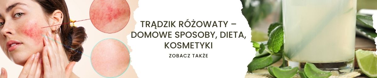 Trądzik różowaty – domowe sposoby, dieta, kosmetyki - obrazek zobacz także