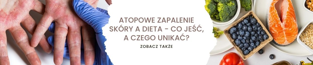 Atopowe Zapalenie Skóry a dieta - co jeść, a czego unikać - obrazek zobacz także