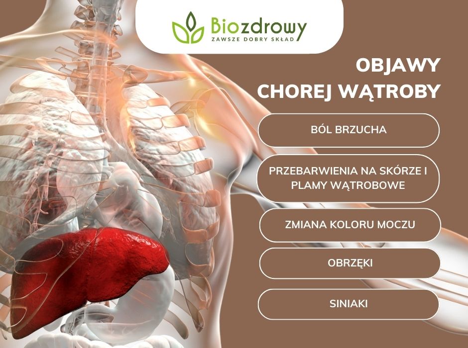 Objawy chorej wątroby infografika