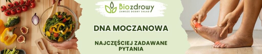 Dna moczanowa FAQ - obrazek poglądowy