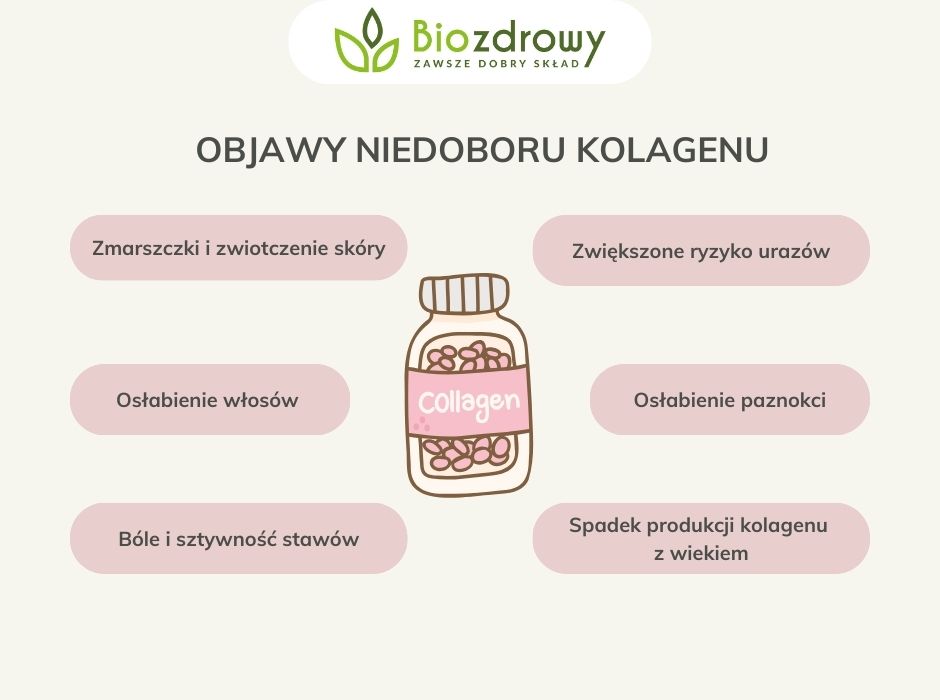 Objawy niedoboru kolagenu - infografika