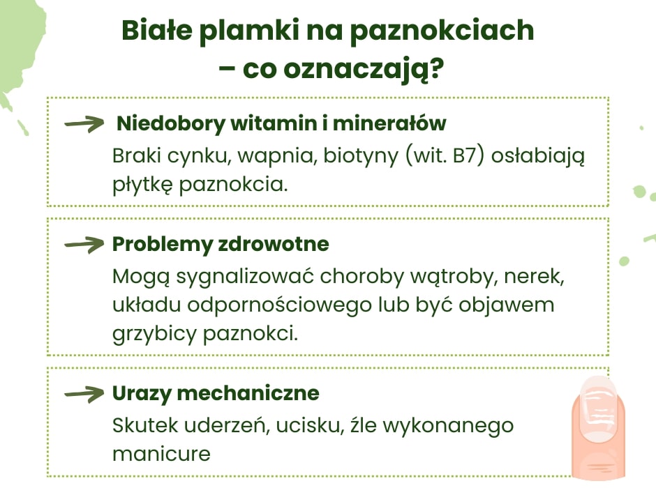 Co oznaczają białe plamki na paznokciach - infografika