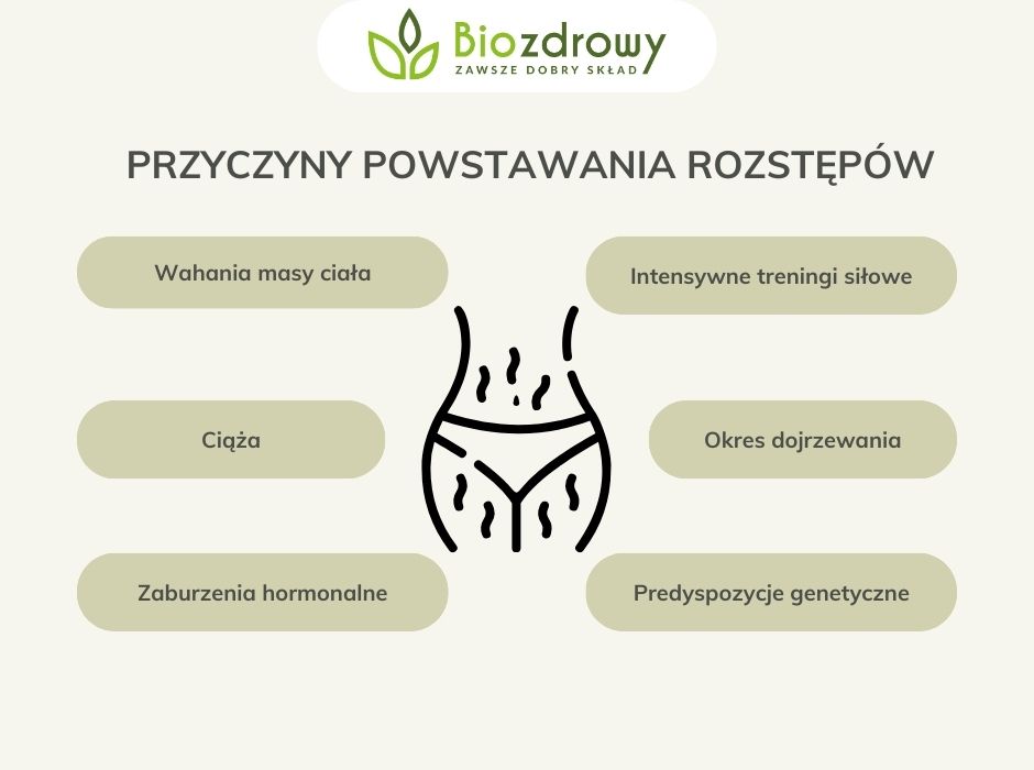 Przyczyny powstawania rozstępów - obrazek wyróżniający