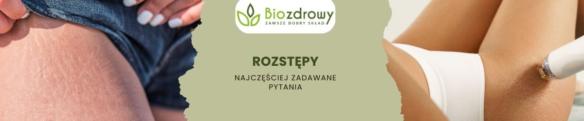 Rozstępy faq - najcześciej zadawane pytania
