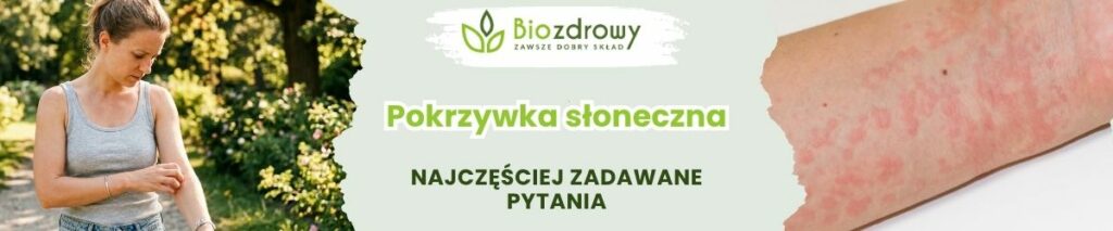 Pokrzywka słoneczna FAQ - obrazek poglądowy